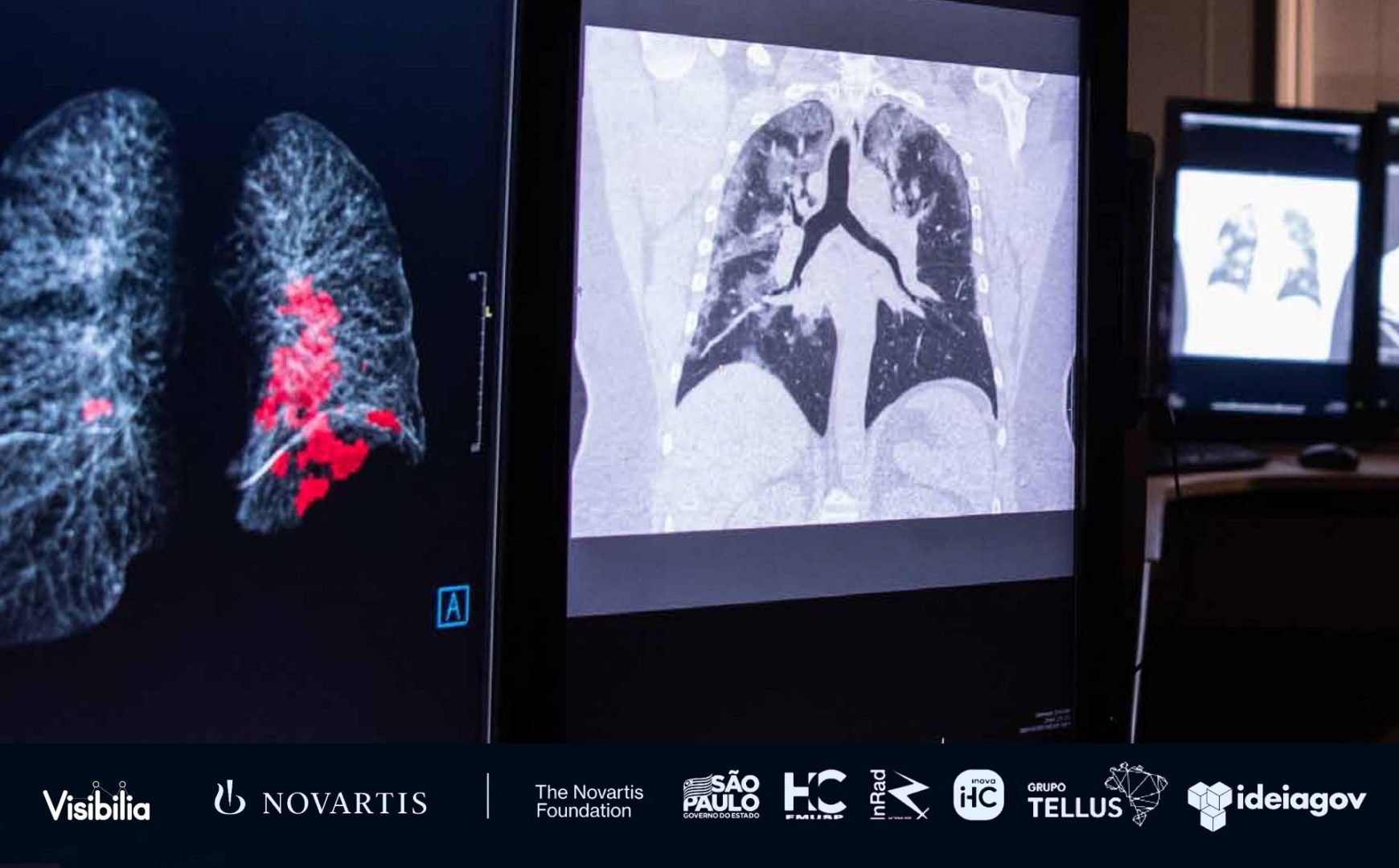 imagem mostra dois computadores com imagens de raio x de pulmão idenntificando covid 19